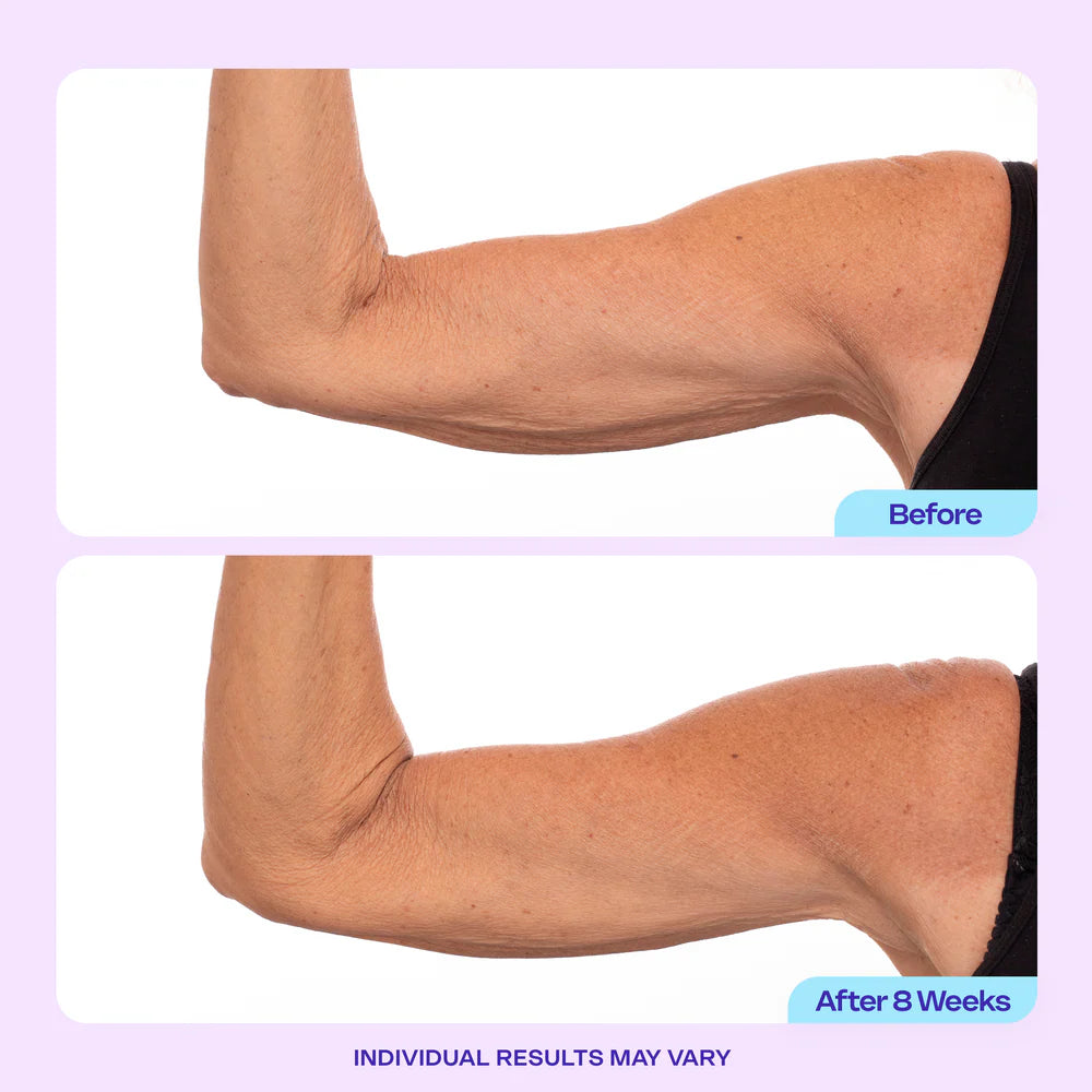 NIVORA Skin Firming Cream