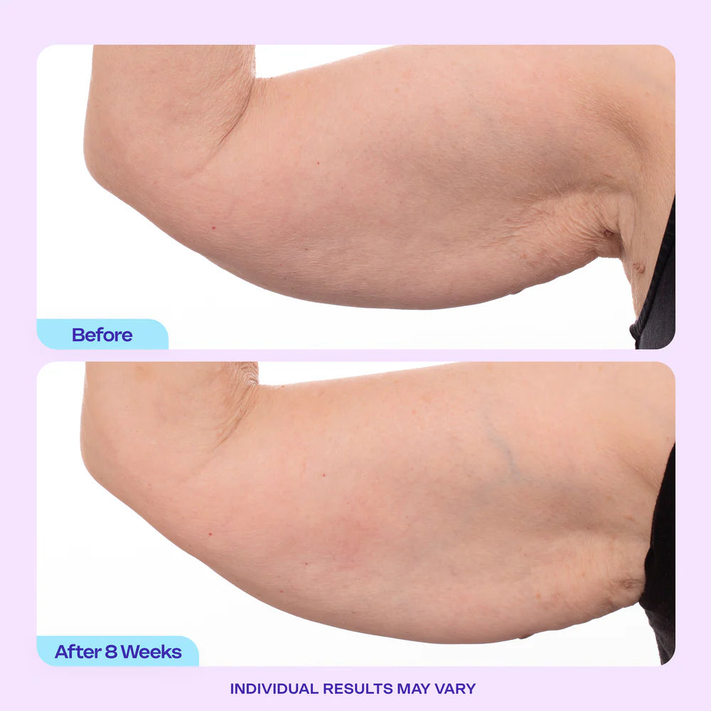 NIVORA Skin Firming Cream