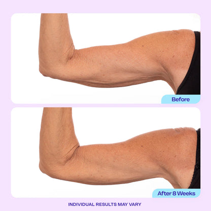 NIVORA Skin Firming Cream